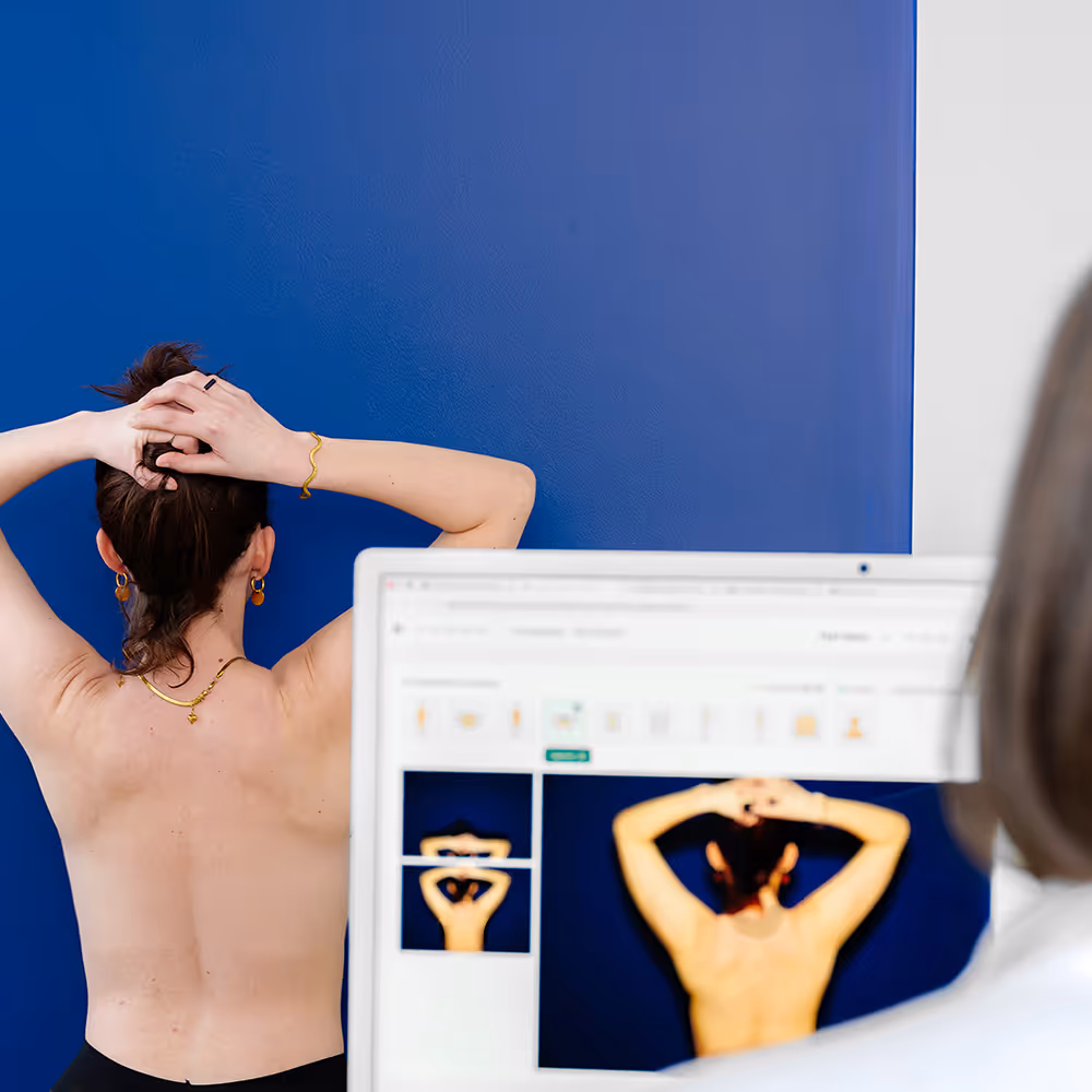 Cartographie corporelle : patiente photographiée devant l'application DermaScan